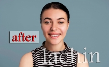 رتوش-پوست-حذف-جوش-ایرادات-پوستی-اصلاح-رنگ-نور-ایرادات-تصویر