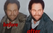 عکس-قدیمی-آسیب-دیده-عزیزانتون-ترمیم-لبخند-رضایت-لبتون-بنشونم