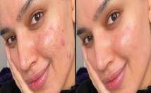 حذف-شخص-اشیا-حذف-لوگو-روتوش-سبک-حذف-بک-گروند